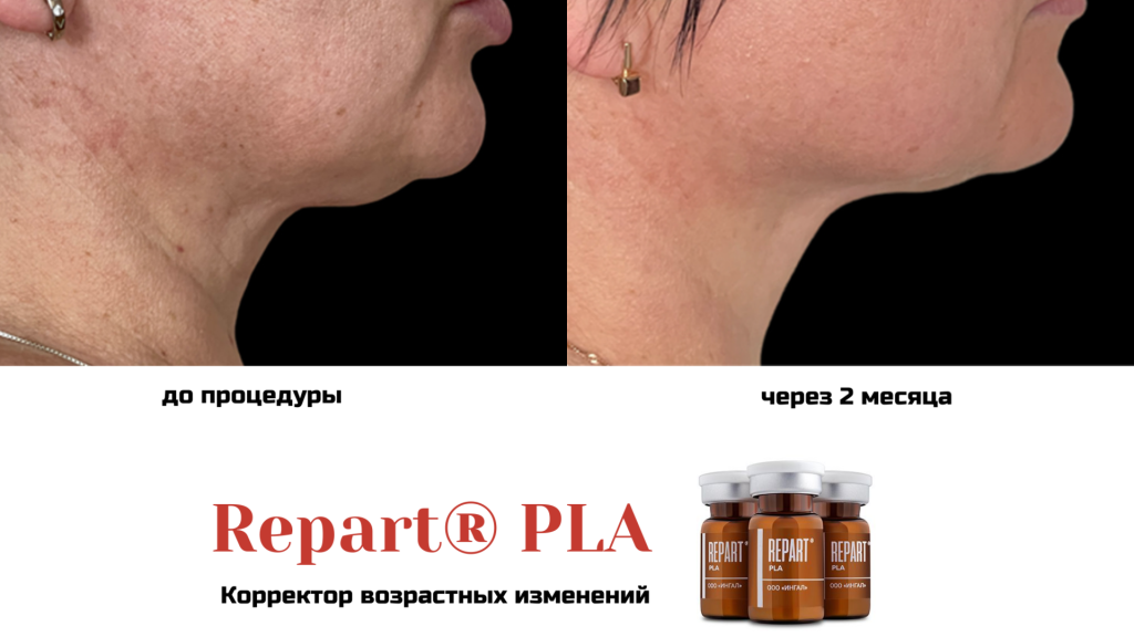 До после.png До после.png